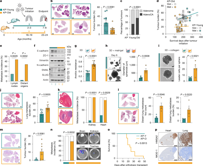  Ageing promotes metastasis via activation of the integrated stress response