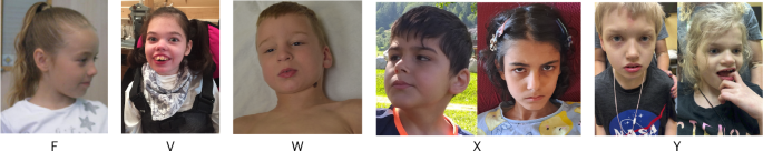 Fig. 4: Clinical photographs.