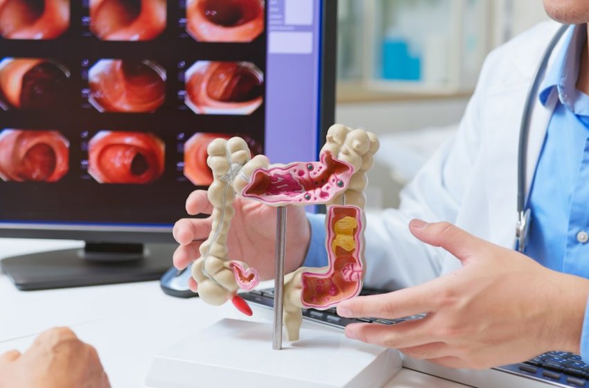  As colon cancer rises in younger adults, D-FW scientists uncover crucial clue