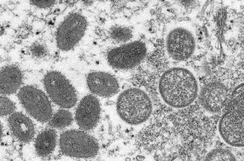  Missouri reports first clade I mpox cases in state | News