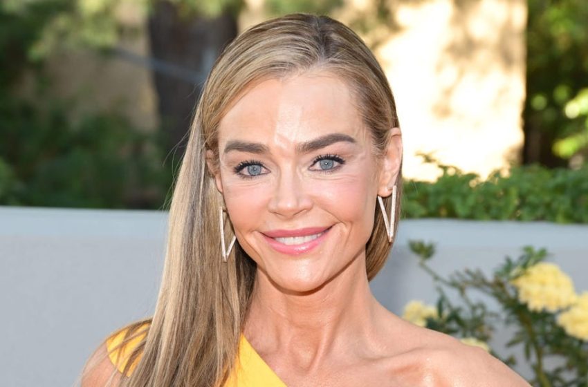  Facelifts Aren’t Embarrassing Anymore, and Denise Richards Is Proof