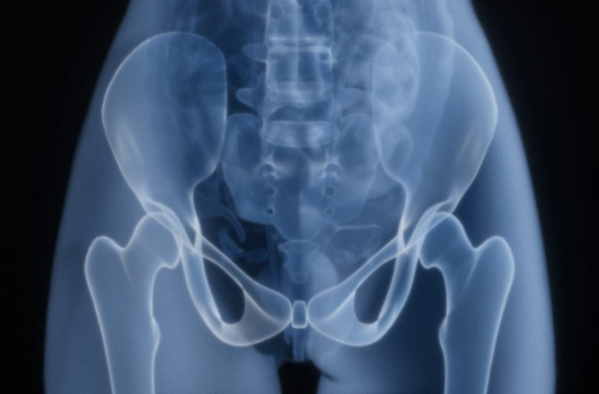  The Best Fruit For Healthy Bones