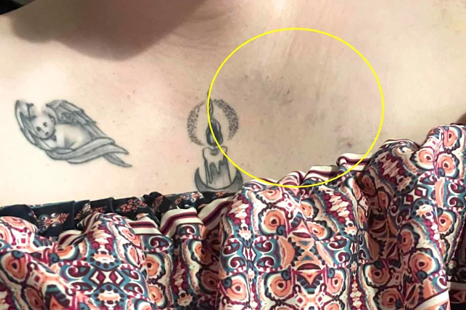 Zoe McGroarty's body amid her health struggles.Credit: Kennedy News & Media