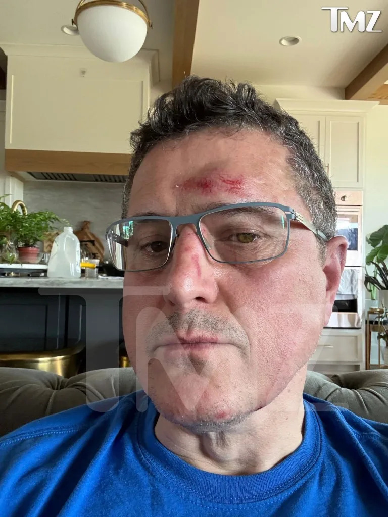 Taylor showed his injuries to TMZ on Monday that he alleges were Ritchson’s doing. TMZ