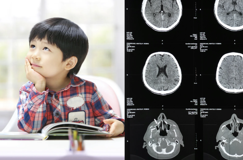  16-yr-long ADHD study proves researchers’ hypothesis wrong