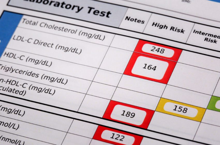 New heart disease guidelines suggest statins as early as age 30