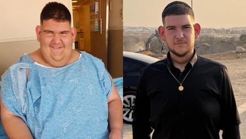  teen loses 113 kg after obesity struggle