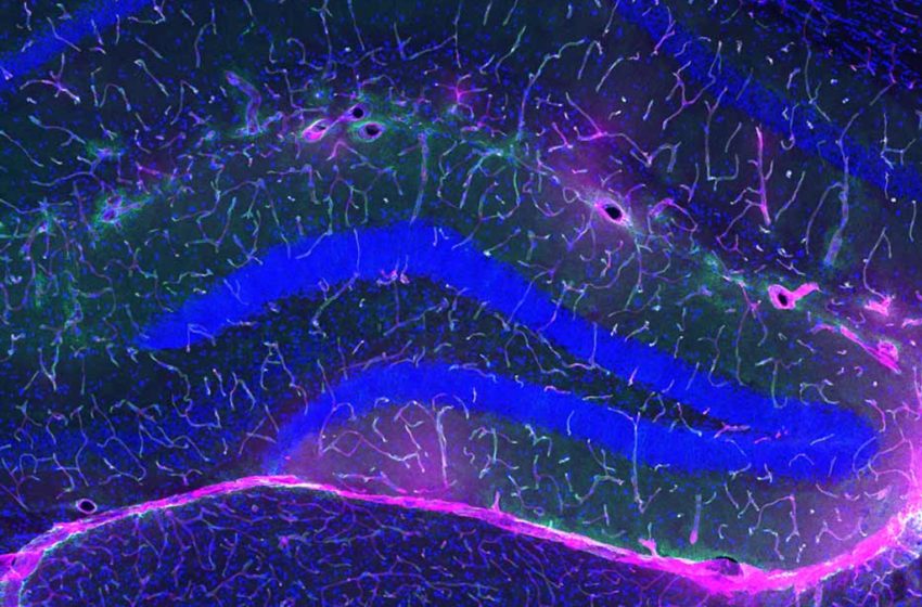  Exercise Protects Against Alzheimer’s, And Scientists May Finally Know Why : ScienceAlert