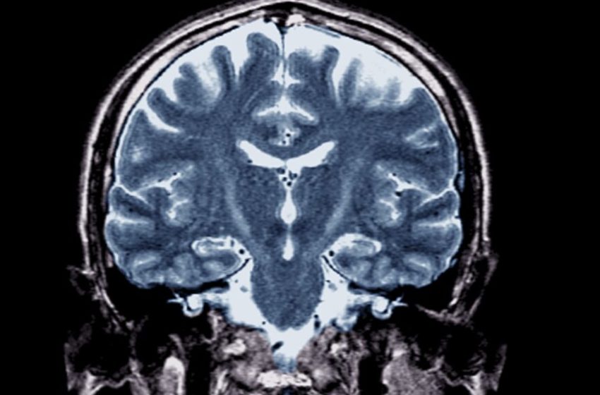  With Trump in office, an ALS cure seems farther than ever