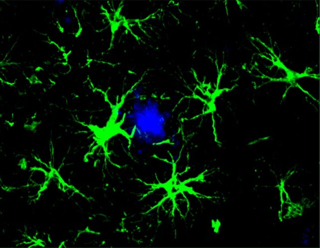 image of astrocytes targeting protein linked to Alzheimer's disease