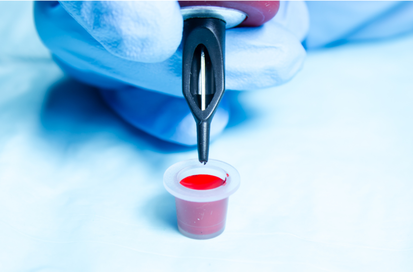  Diagnostic dilemma: A cross tattoo on a man’s neck disappeared — killing his skin as it did so