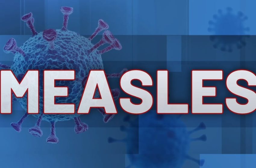  Potential measles exposure linked to eastern Iowa hotel