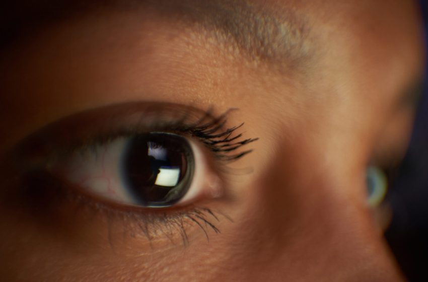  Why are vertebrate eyes so different from those of other animals?