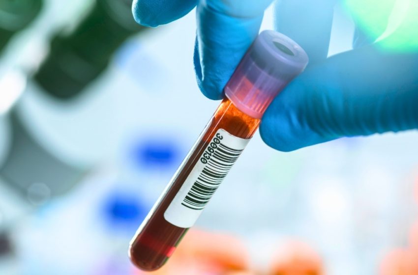  Blood Tests Could Revolutionize Early Cancer Detection – But There’s a Catch : ScienceAlert