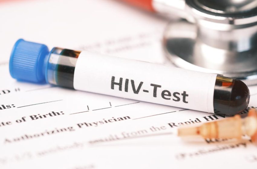  Eastern Idaho sees ‘concerning increase’ in HIV infections