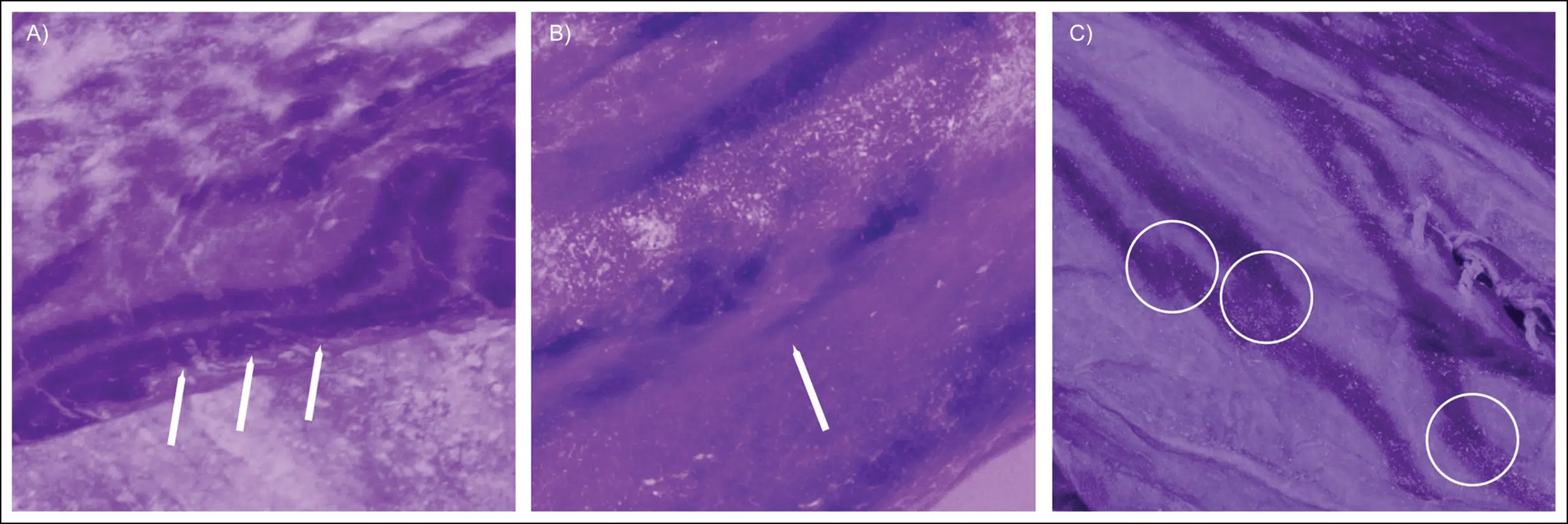 Insights Into The Techniques Used To Execute The Tattoos