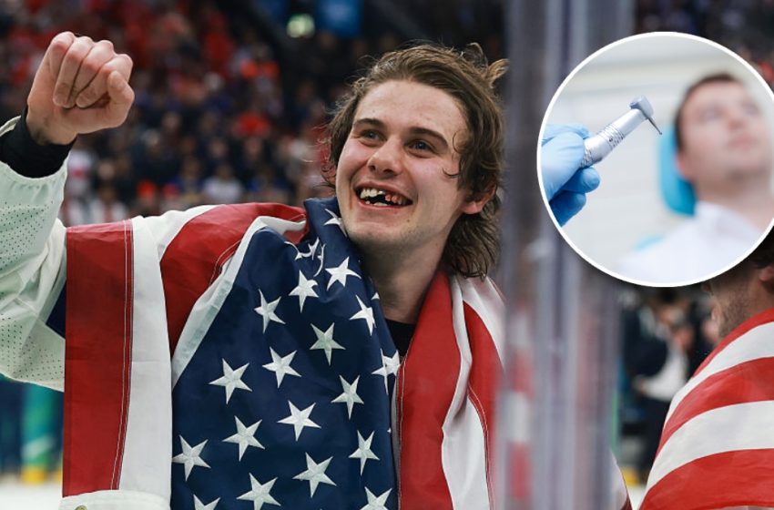  Jack Hughes Teases End Of His Very Awesome, Toothless, Gold Medal-Winning Teeth