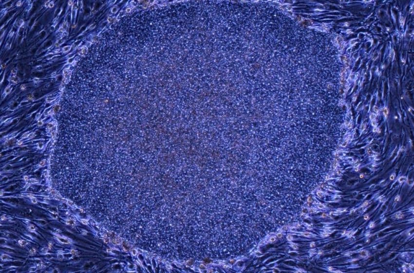  Japan Approves the World’s First Treatments Made With Reprogrammed Human Cells