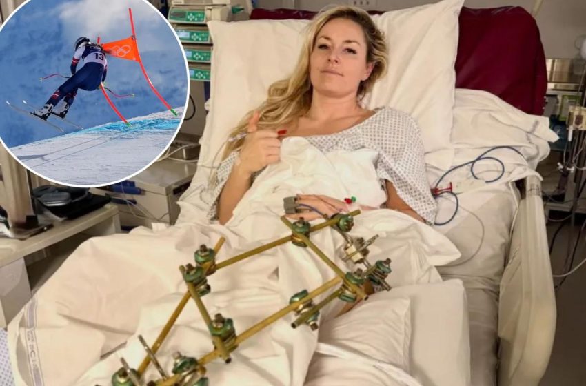  Lindsey Vonn spurns retirement talk after dad’s plea following injury