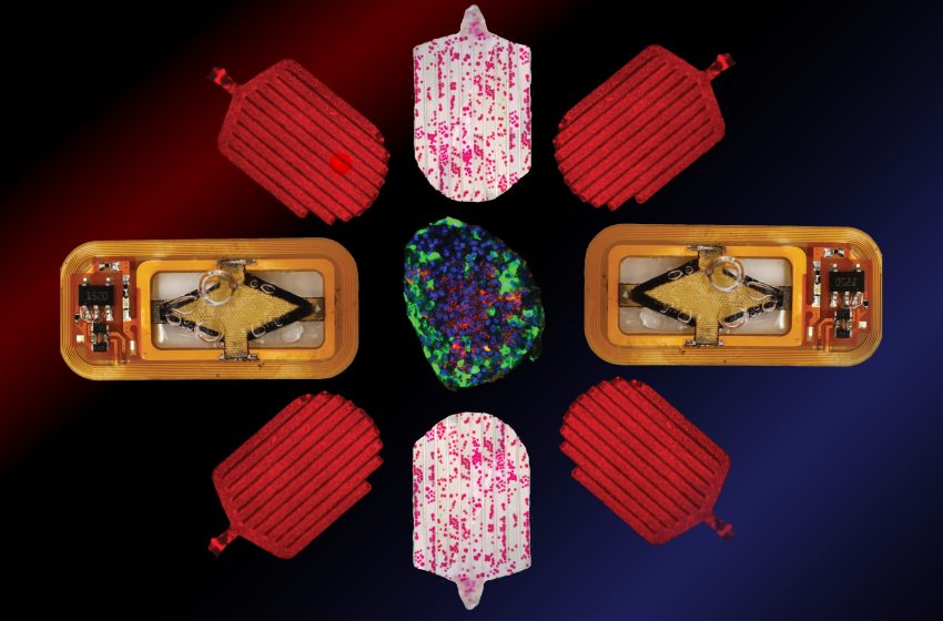  Implantable islet cells could control diabetes without insulin injections | MIT News