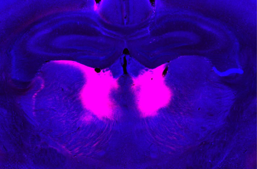  Brain circuit needed to incorporate new information may be linked to schizophrenia | MIT News