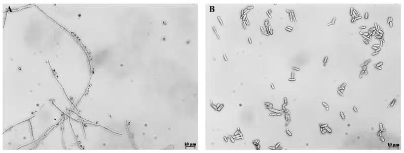 Microscopic Morphology Of Sporothrix Brasiliensis