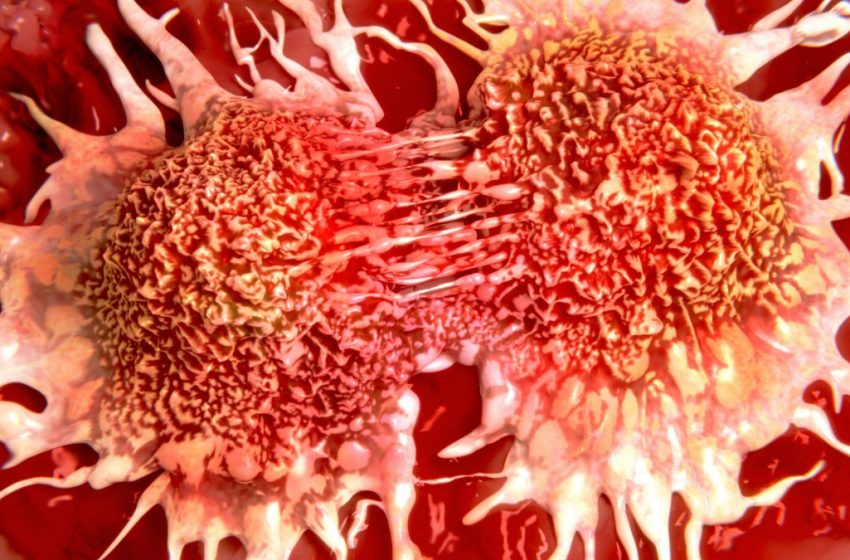  New Experimental Drug Shrinks Tumors in Prostate Cancer Clinical Trial : ScienceAlert