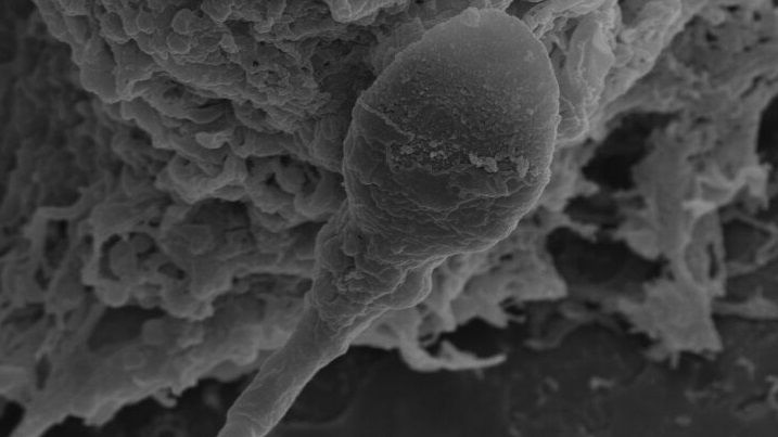  Can humans have babies in space? It may be harder than expected