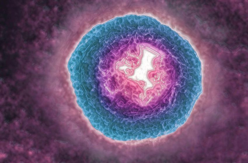  The Shingles Virus May Be Aging You More Quickly