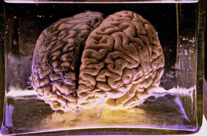  Scientists Revive Brain Activity for the First Time After Seven Days in a Frozen Suspended State