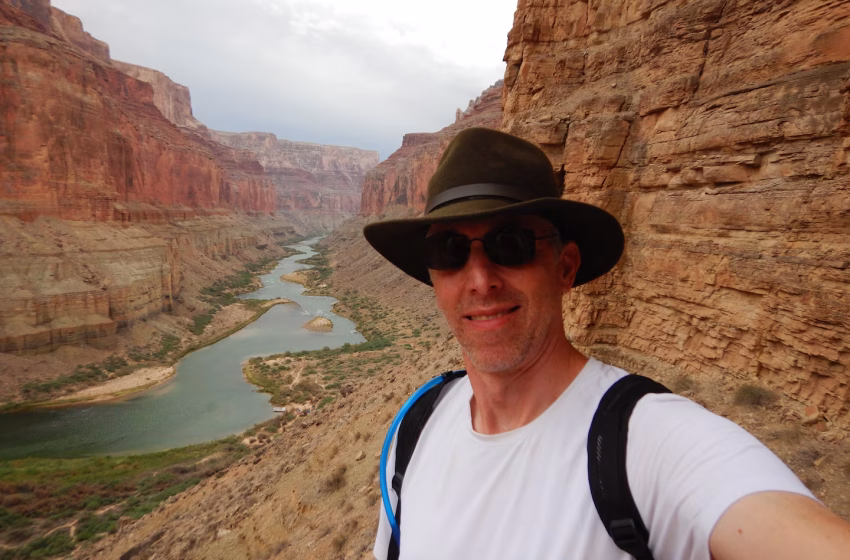  Medical Mysteries: Rare syndrome diagnosed after arthritis misdiagnosis