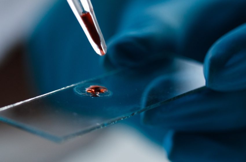  Simple Blood Test Can Predict Dementia Risk in Women Decades Before Symptoms : ScienceAlert