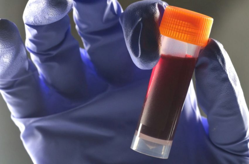  One Blood Type Appears to Carry a Higher Risk of Type 2 Diabetes : ScienceAlert