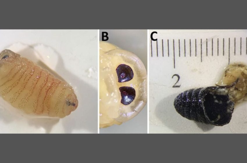  Woman Gets Infested by Maggots, Sneezes Them Out