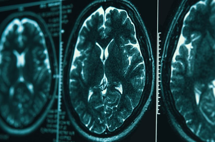  Growing up with solid cooking fuels linked to long-term brain health risks