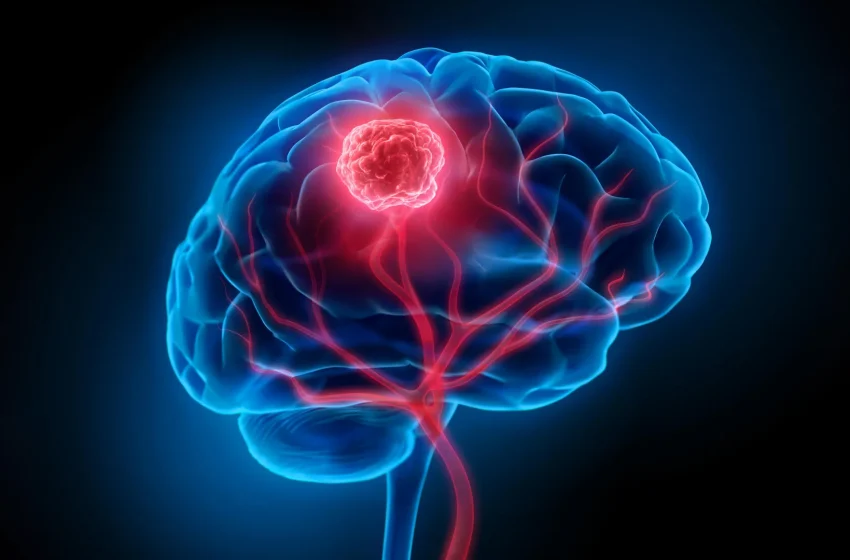  This virus therapy supercharges the immune system against brain cancer