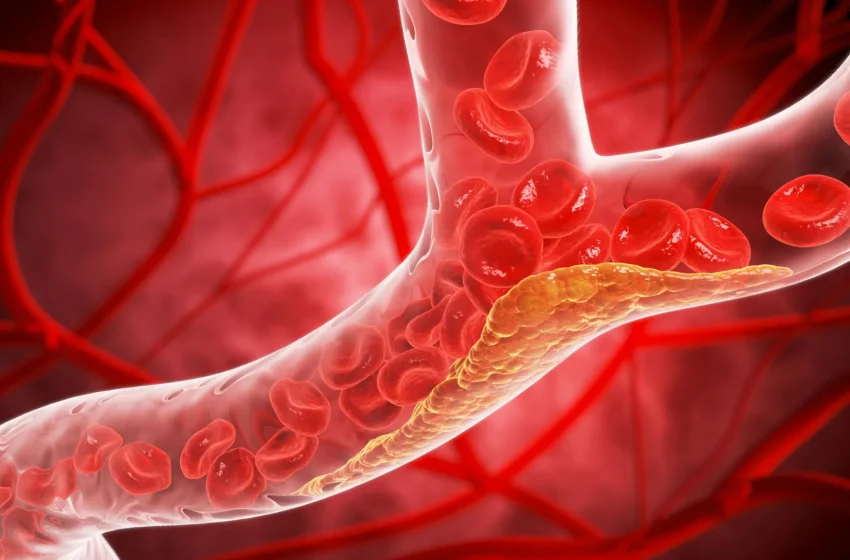  New cholesterol guidelines could change when you get tested