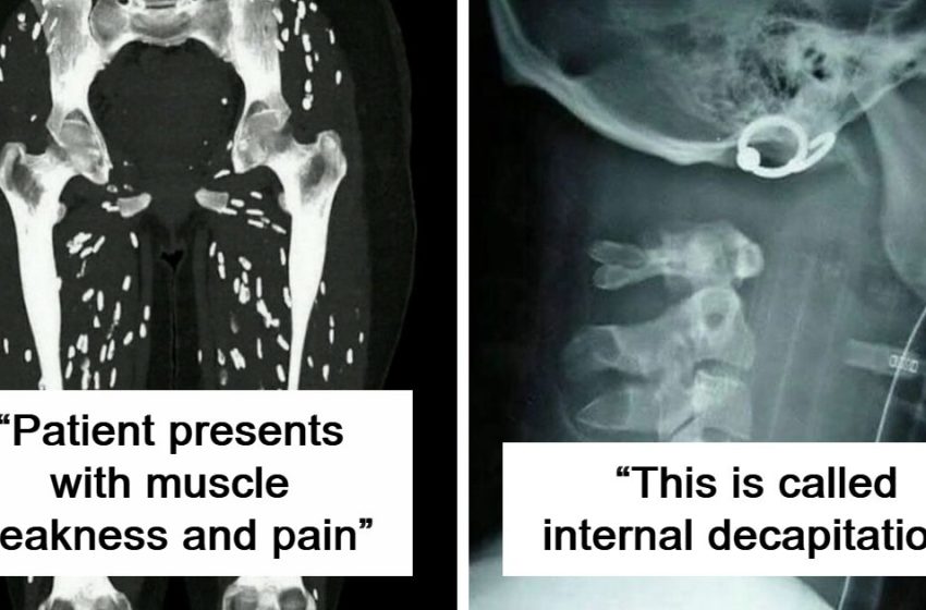  “Man Struck By Lightning”: 41 Rare Medical Photos That May Feel Gross But Are Deeply Fascinating