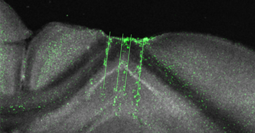  Hippocampus a ‘general-purpose statistical learning machine’