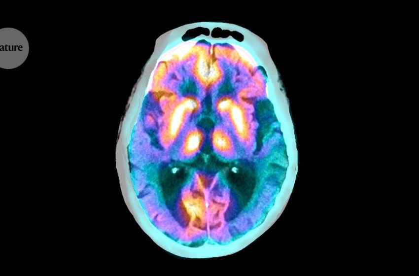  These brain cells clear proteins that contribute to Alzheimer’s