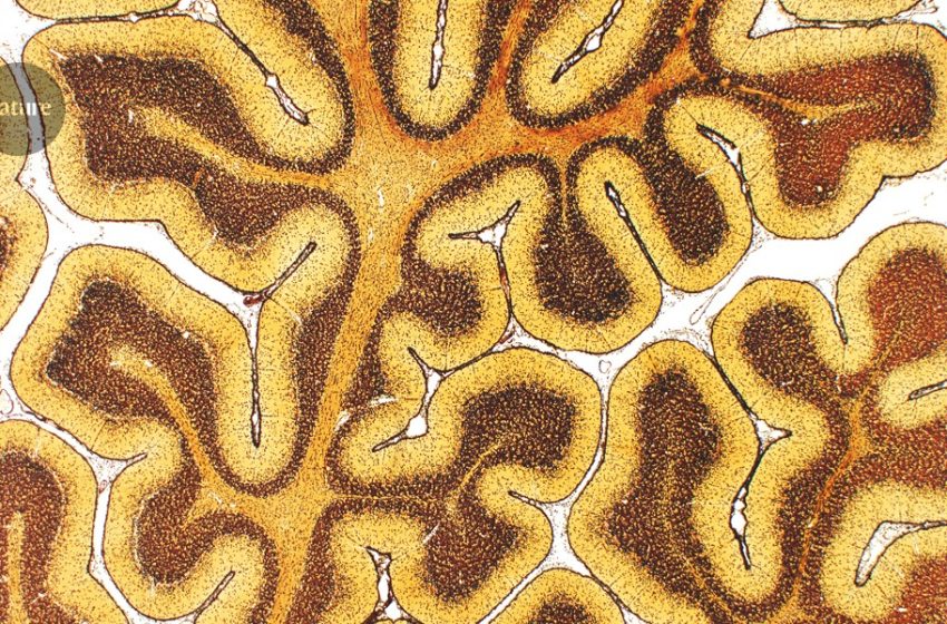  First atlas of brain organization shows development over a lifetime