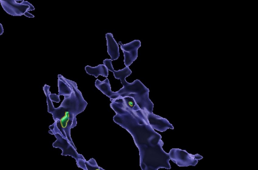  Microplastics that accumulate in the body may ‘clog up’ immune cells