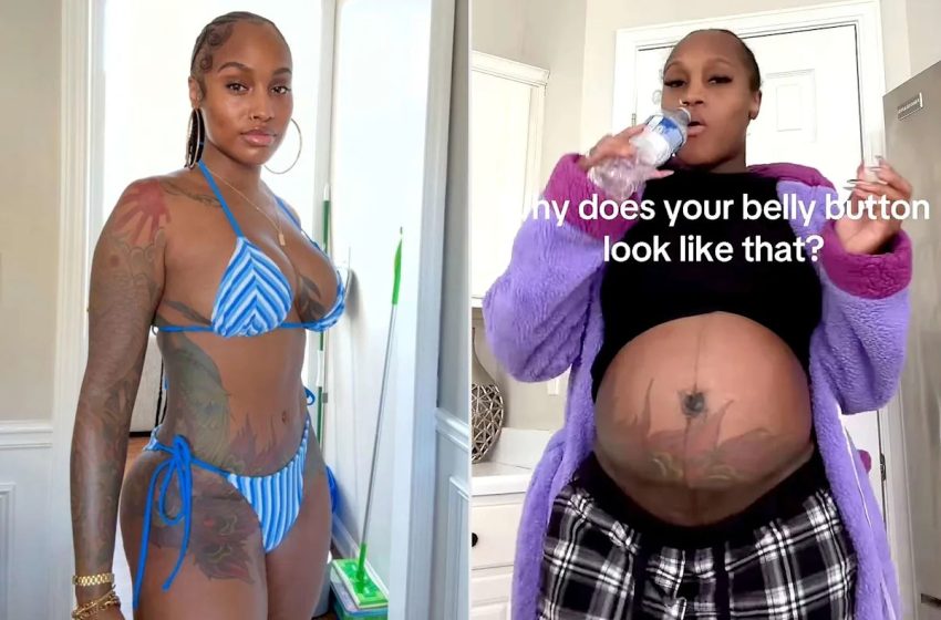  Woman, 34, Got a Tummy Tuck After Having 3 Kids. She Was Shocked by How the Plastic Surgery Affected Her 4th Pregnancy (Exclusive)