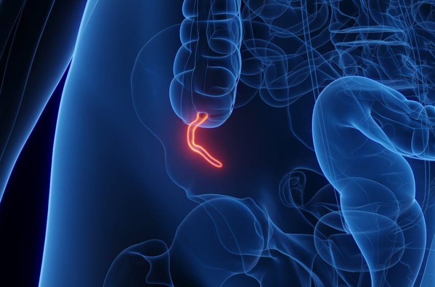  What does the appendix do? Biologists explain the complicated evolution of this inconvenient organ