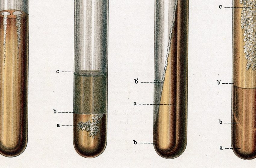 The world’s deadliest infectious disease is on the rise in the US