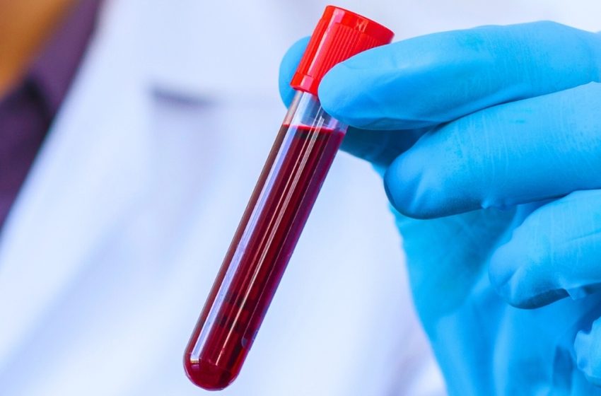  The Blood of Centenarians Reveals 37 Proteins Linked With Slower Aging : ScienceAlert