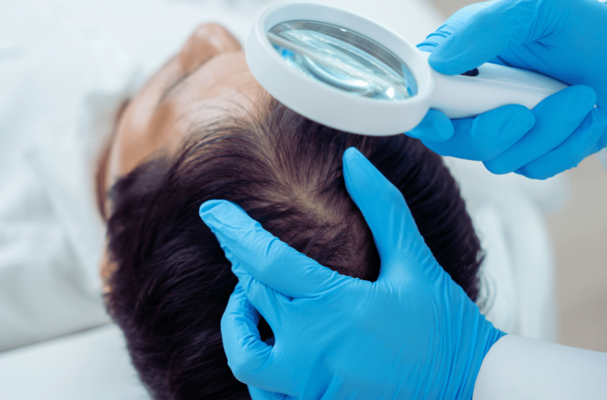  A Game-Changer for Hair Loss