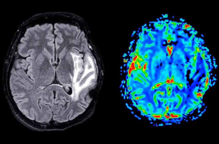  Scientists Just Found Alzheimer’s Hidden ‘Death Switch’ — And They May Have Found a Way to Turn It Off