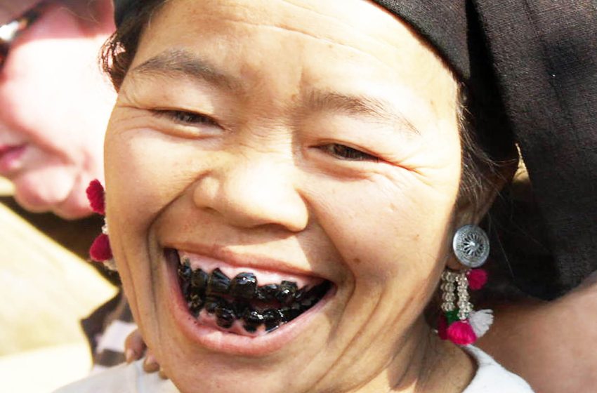  Tooth blackening beauty trend in Vietnam began 2,000 years ago