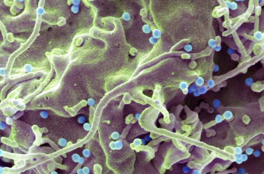  A new one-a-day-pill holds promise for HIV's 'forgotten population' – NPR